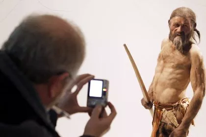 Ötzi: Dunkle Haut, Glatze, anatolische Vorfahren