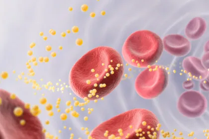 Ist ein hoher Cholesterinspiegel wirklich schädlich? Es kommt darauf an