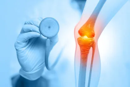 Rheumatoide Arthritis: Wenn das Immunsystem die Gelenke angreift