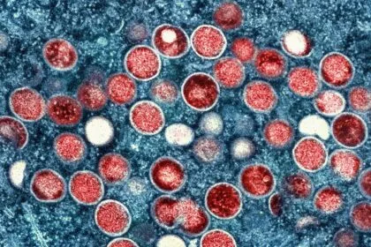 Berlin: Die Zahl der Mpox-Fälle steigt stärker an als in den Jahren zuvor