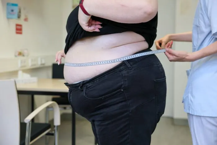 Laut Daten des Statistischen Bundesamtes von 2025 sind in Deutschland 17,9 Prozent der Erwachsenen adipös. (Symbolbild)