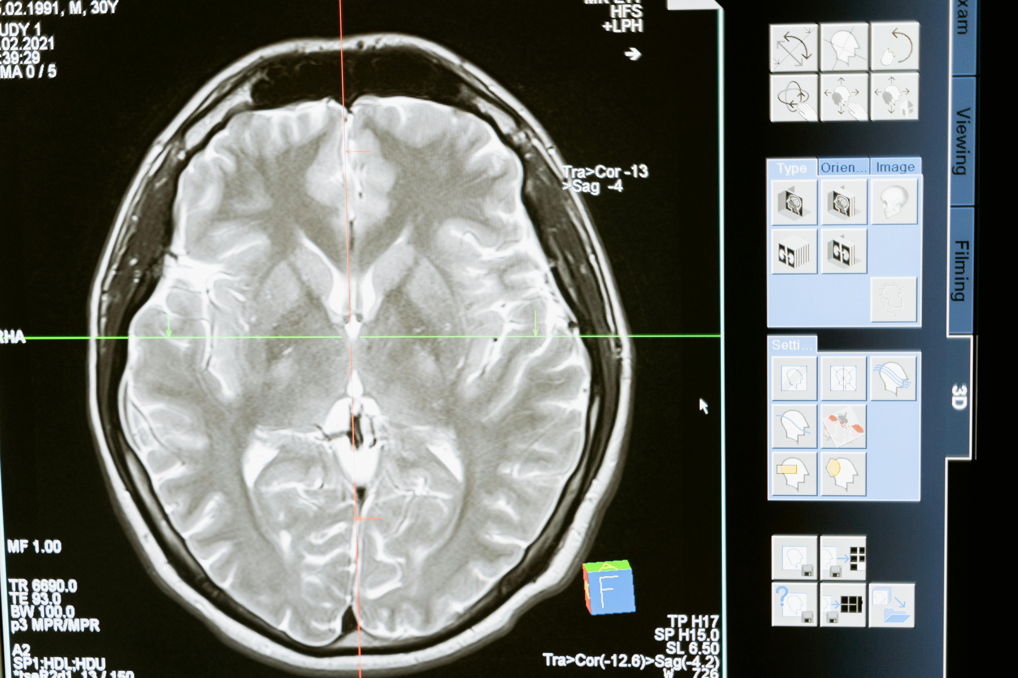 #DisMoiPourquoi, Est-ce que notre cerveau dort&nbsp;?