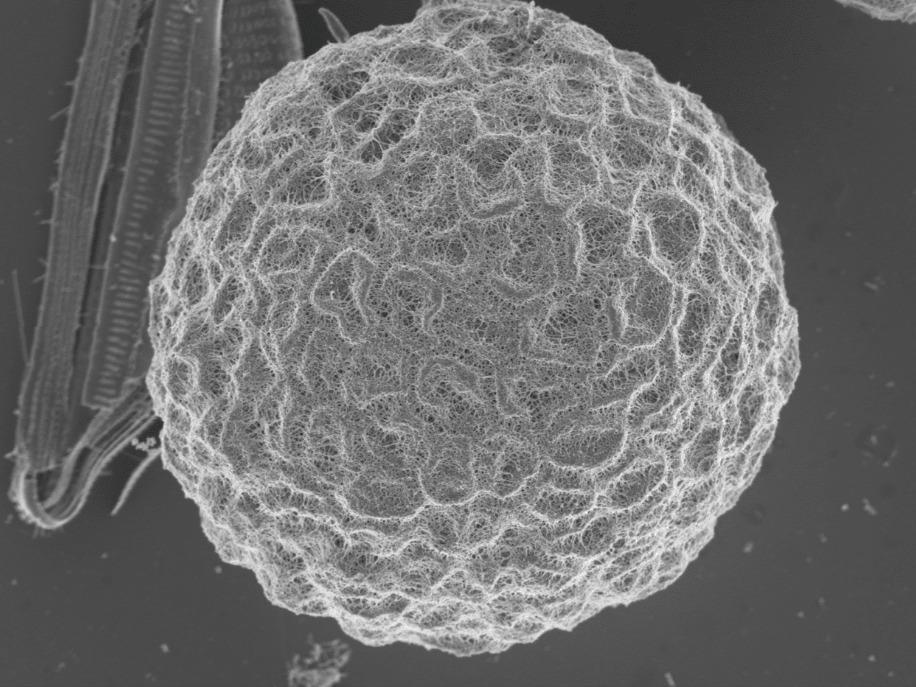[Sciences] Une boule de bactéries géante découverte à Carry-le-Rouet