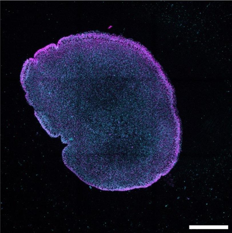 [Sciences] Sans muscles ni neurones, cet animal «&nbsp;crêpe&nbsp;» s’enfuit face au danger